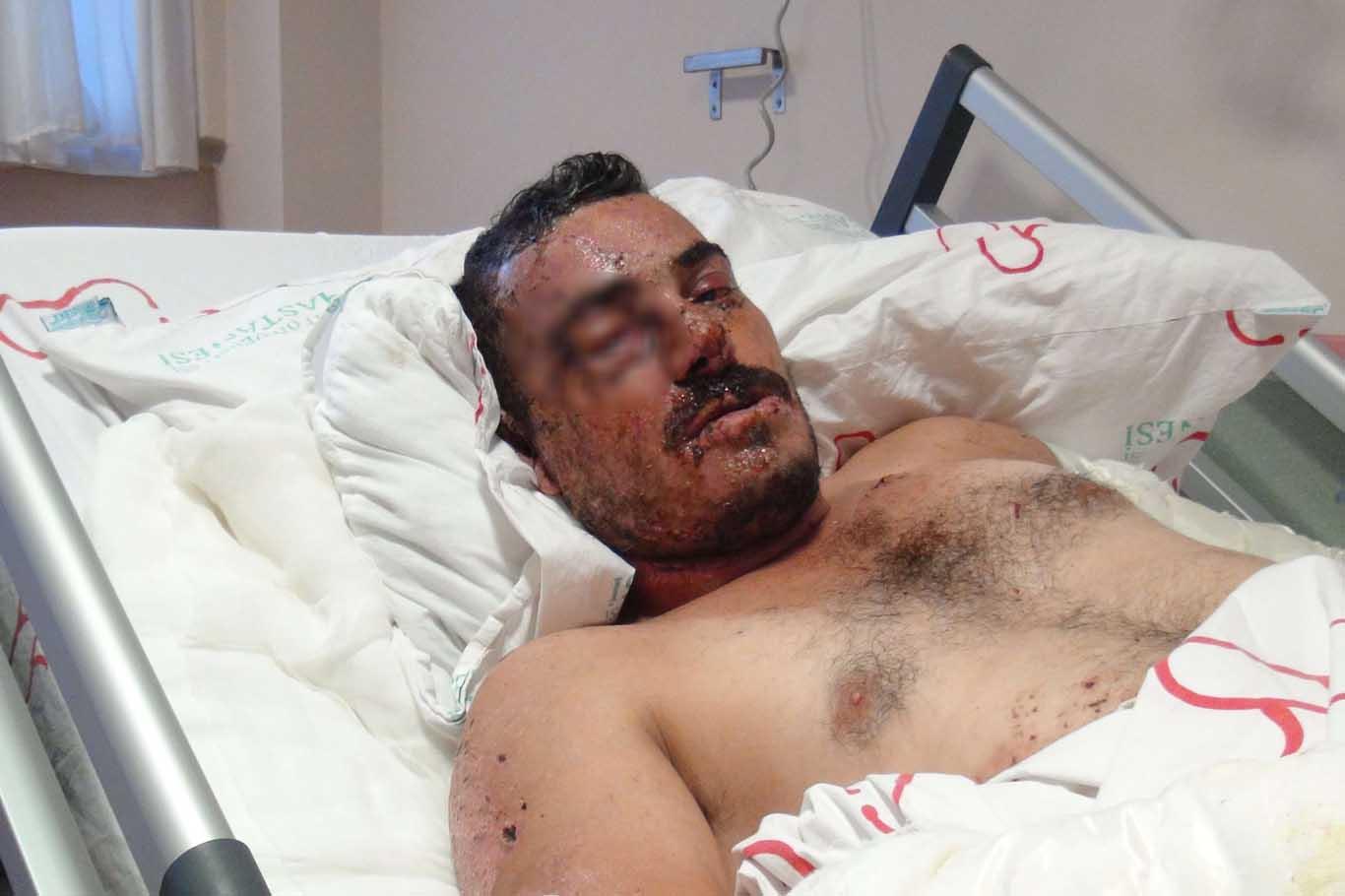 Elazığ’daki patlamada ağır yaralanan kamyoncu o anları anlattı Elazığ’daki patlamada ağır yaralanan kamyoncu o anları anlattı